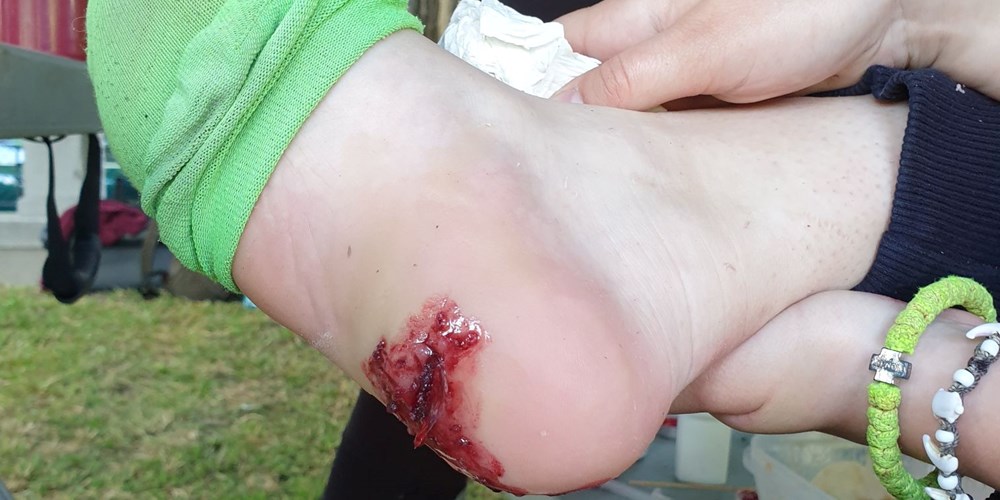 Našminkana povreda stopala